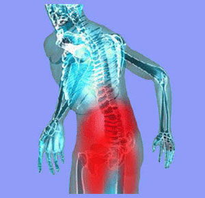 Difference Between Sciatica and Lower Back Pain